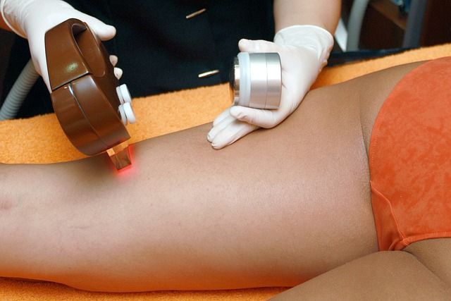 Depilacja Laserowa: Jak się Przygotować? - galeria