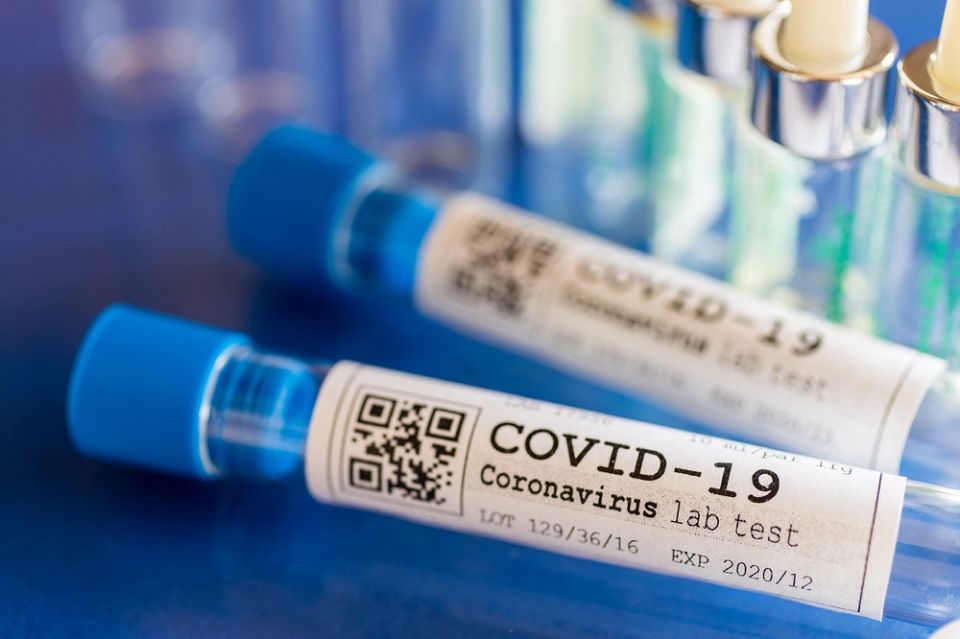 Ministerstwo Zdrowia poinformowało o 99 nowych przypadkach zakażenia koronawirusem - galeria