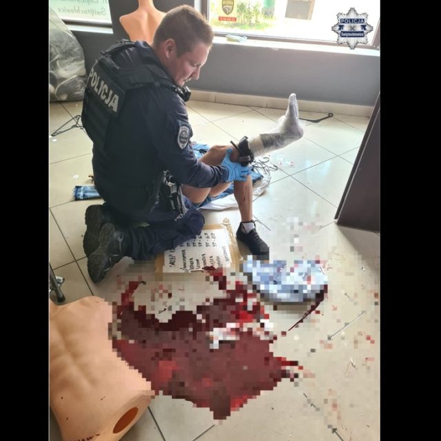 Groźny wypadek podczas zmiany lokalu. Policjanci uratowali 51-latkę z rozległą raną nogi